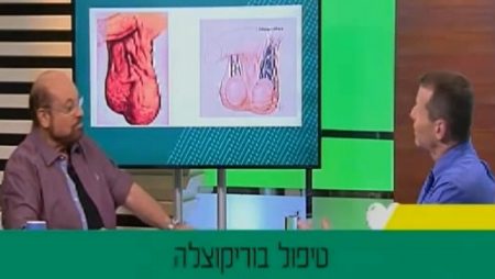 וריקוצלה - אבחון וטיפול